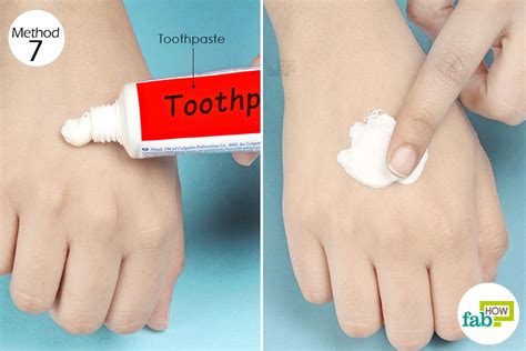 Does toothpaste help bee stings?