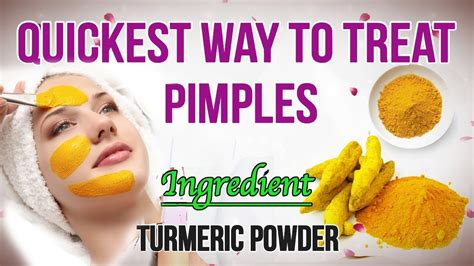 Does turmeric and yogurt remove pimples?