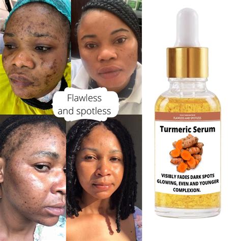 Does turmeric remove melanin?