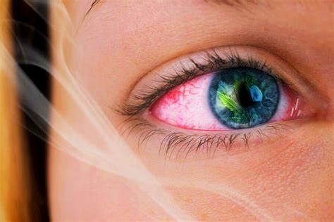 Does vaping make your eyes red?