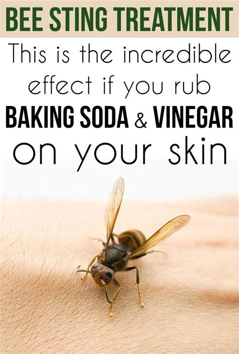 Does vinegar help bee or wasp stings?