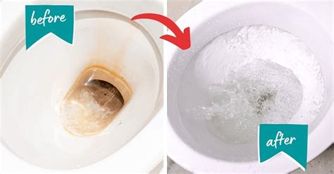 Does vinegar remove limescale from toilet?