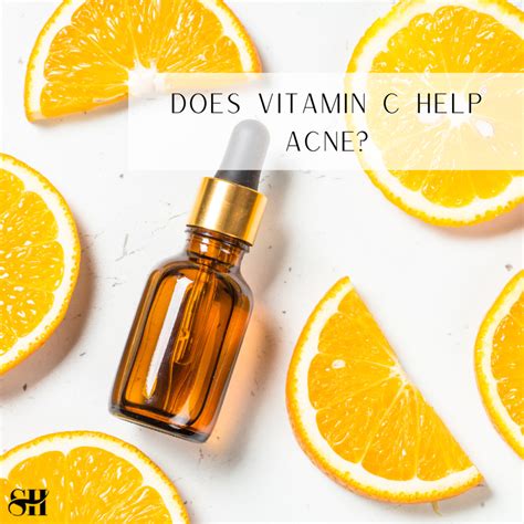 Does vitamin C help with acne?