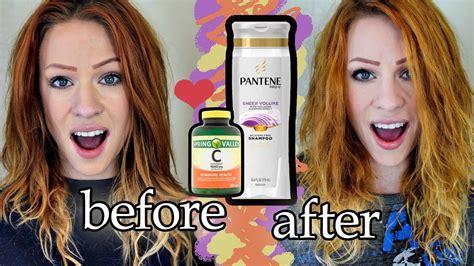 Does vitamin C lighten hair?