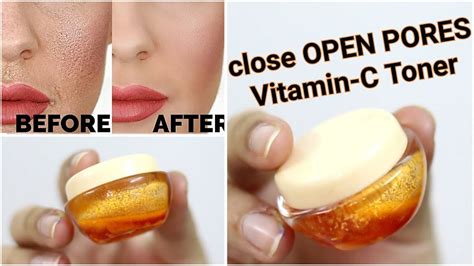 Does vitamin C tighten skin?
