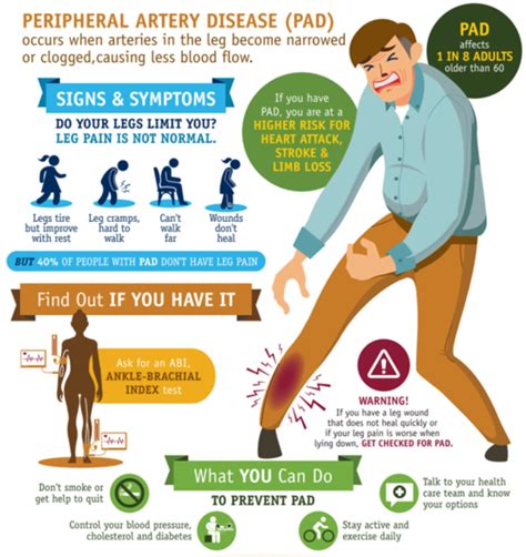 Does walking help PAD in the legs?