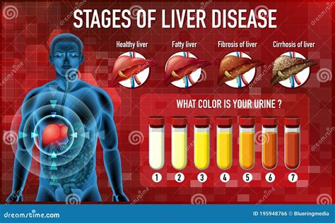 Does welding affect liver?