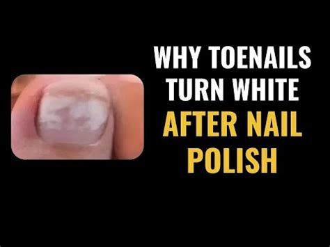 Does white nail polish stain?