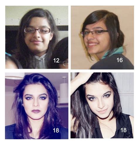 Does your face change at 15?