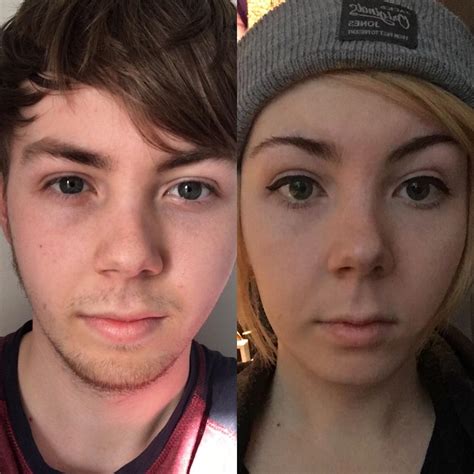Does your face change from 14 to 18?