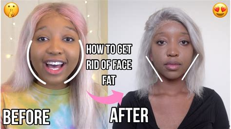 Does your face slim down after 18?