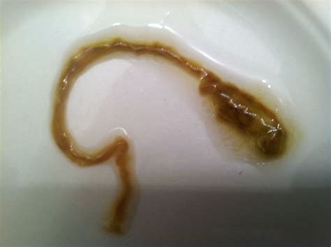 Does your poop look different if you have a tapeworm?