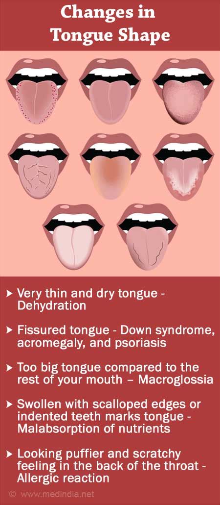 Does your tongue change shape?