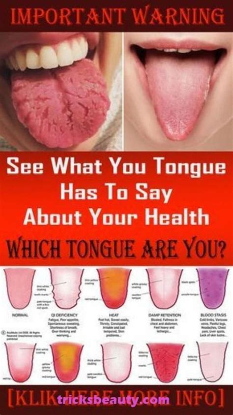 Does your tongue get smaller when you lose weight?