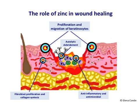 Does zinc heal wounds?