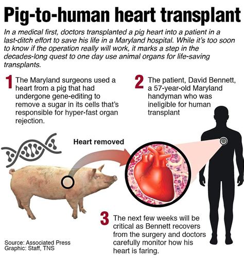 Has a human ever had a pig heart transplant?