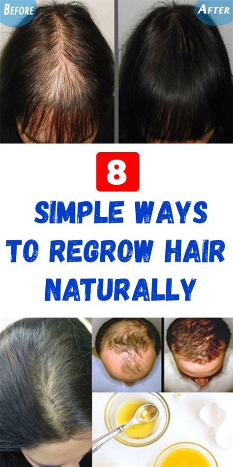 Has anyone successfully regrow hair?