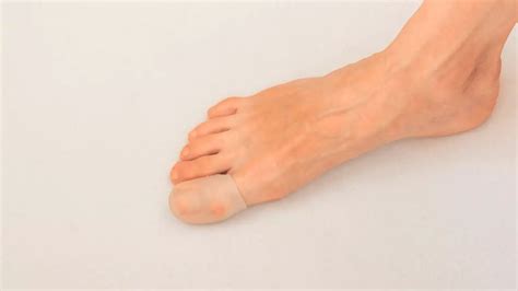 How I cured my Morton's neuroma?