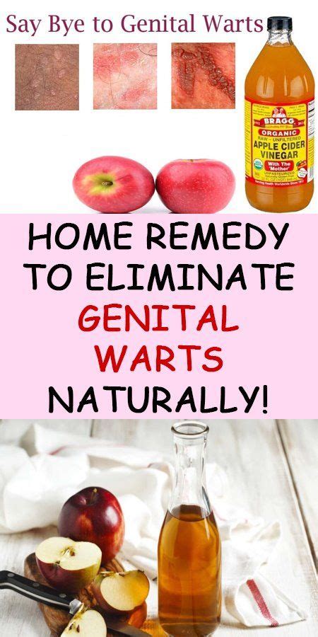 How I cured my genital warts naturally?