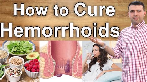 How I healed my hemorrhoids?