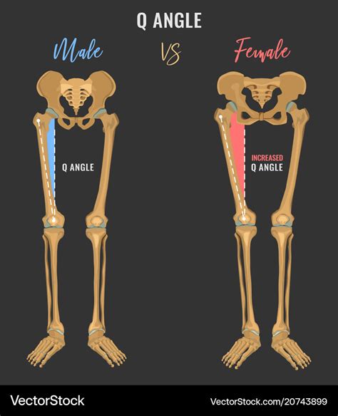 How are women's legs different from men's?