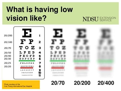 How bad is 20 800 Vision?