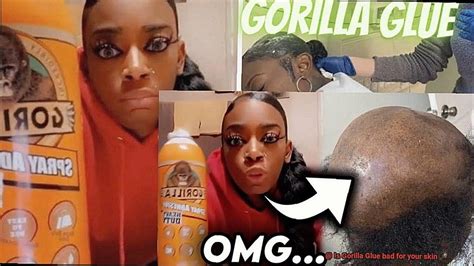 How bad is Gorilla Glue for skin?