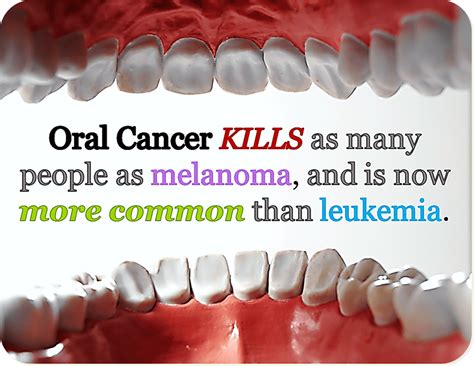 How bad is oral cancer?