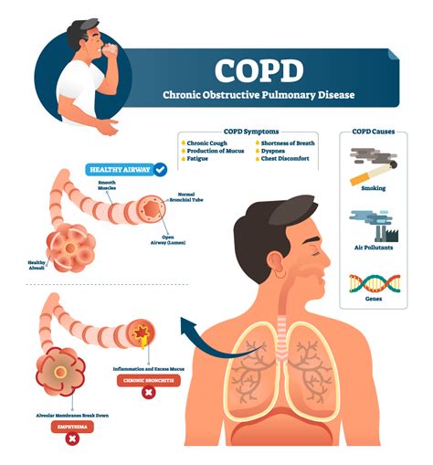 How bad is stage 2 COPD?