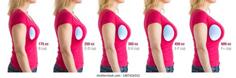 How big is a 32 C breast?