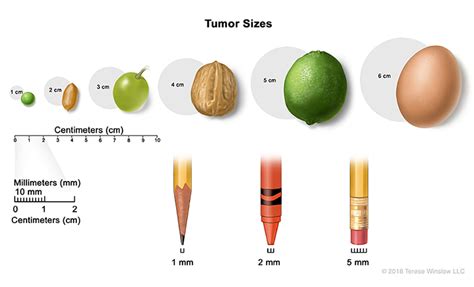 How big is a 5 cm tumor?