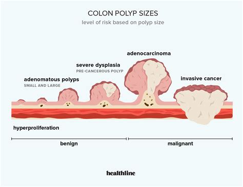 How big is a normal polyp?
