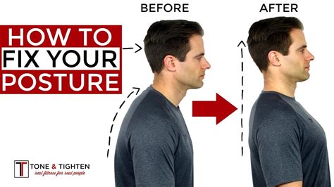 How can I correct my neck posture?