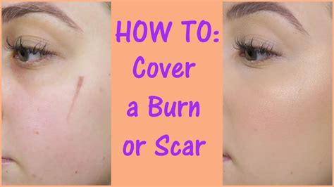 How can I cover up a white scar?