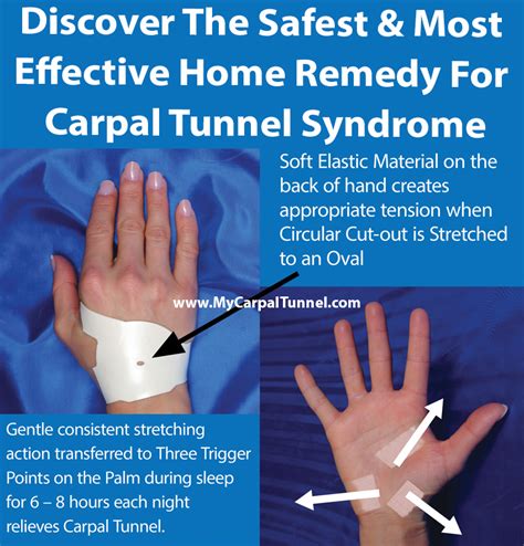 How can I cure my carpal tunnel naturally?