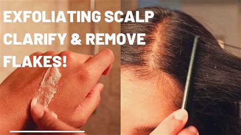 How can I exfoliate my scalp naturally?