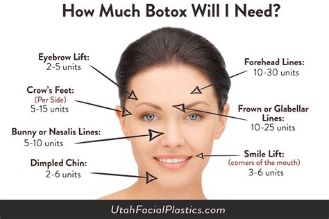 How can I extend my Botox life?