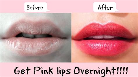How can I lighten my dark lips overnight?