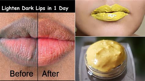 How can I lighten my lips in a week?