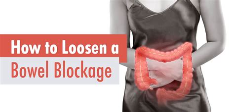 How can I loosen my bowel blockage at home?
