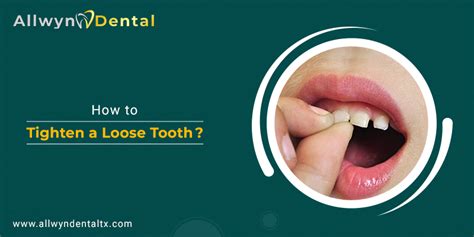 How can I loosen my teeth naturally?