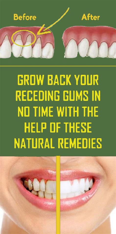 How can I make my gums healthy again?