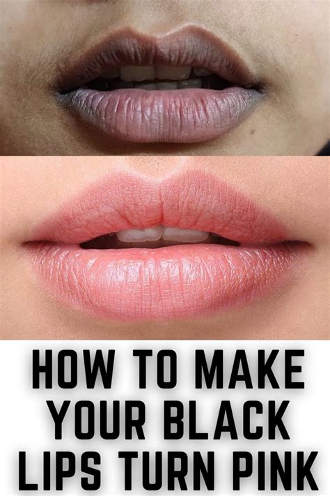 How can I make my lips pink in 2 hours?