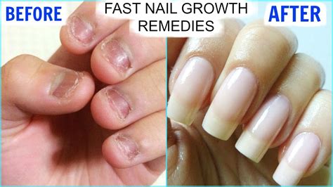 How can I make my nails grow longer?