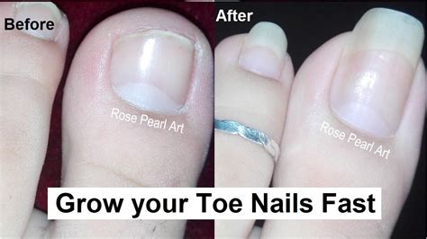 How can I make my toenail grow back faster?