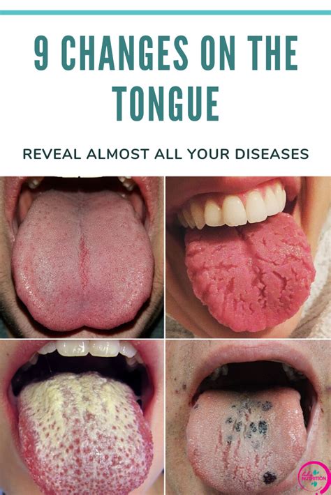 How can I make my tongue pink again?