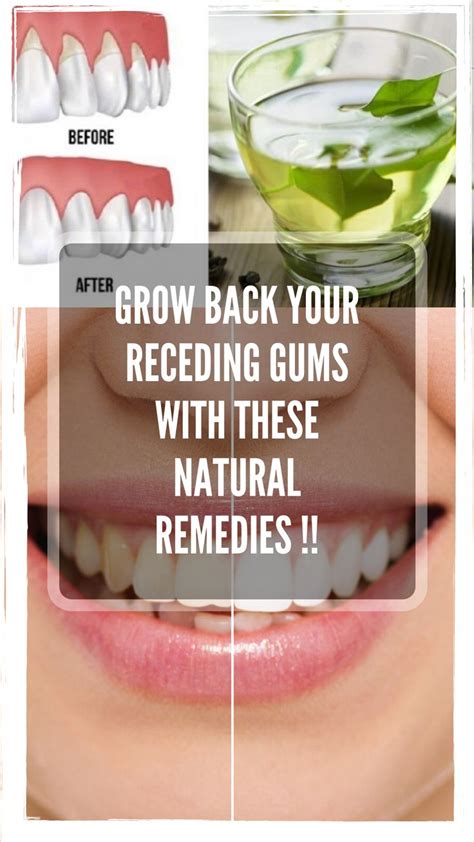 How can I push my gums back naturally?