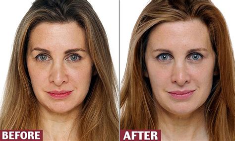 How can I rebuild collagen in my face?