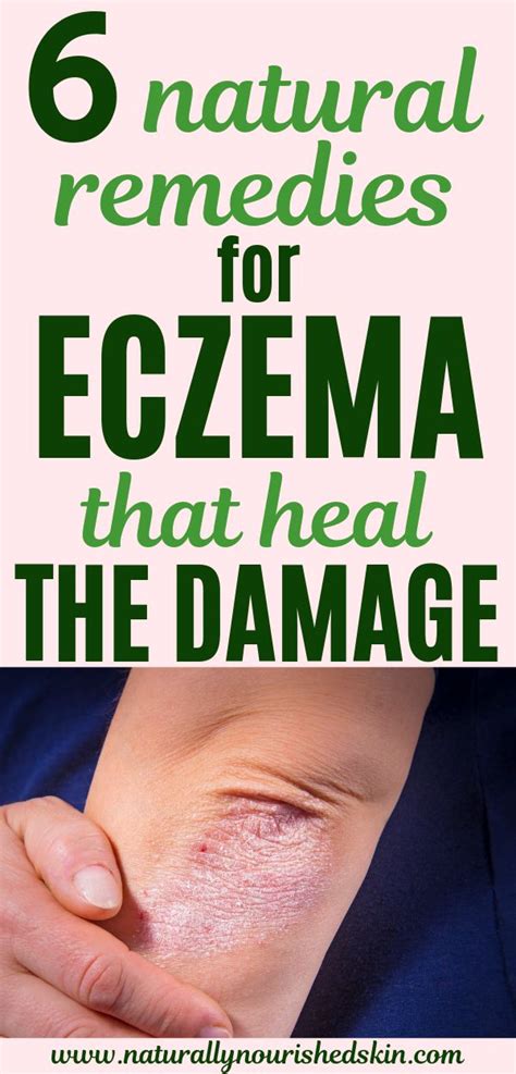 How can I speed up the healing of eczema?