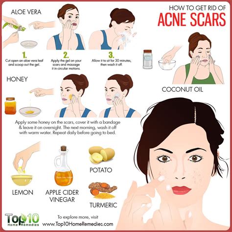 How can I stop acne scarring?